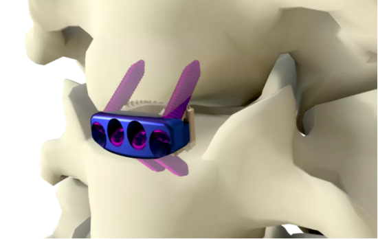 中国有五个，2022全球骨科器械十大事件